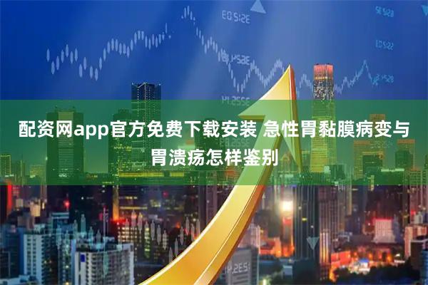 配资网app官方免费下载安装 急性胃黏膜病变与胃溃疡怎样鉴别